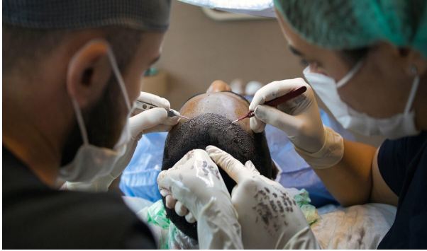 Your Hair, Your Confidence – Back with Bio-DHT